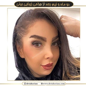 جراحی-بینی-359