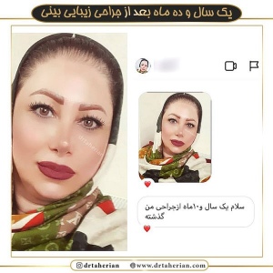 جراحی-بینی-360