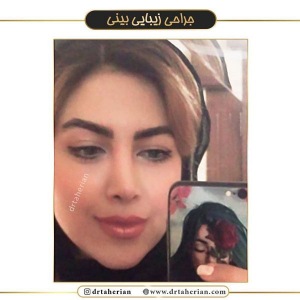 جراحی-بینی-365