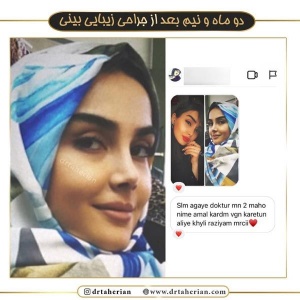 جراحی-بینی-374