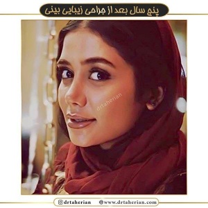 جراحی-بینی-380