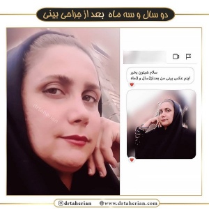 جراحی-بینی-382