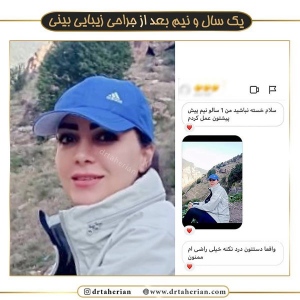 جراحی-بینی-383