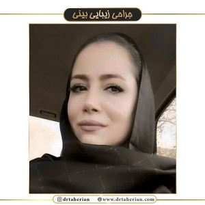 جراحی-بینی-385