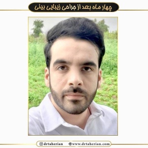 جراحی-بینی-392