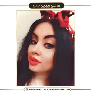 جراحی-بینی-397