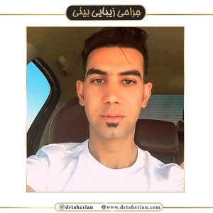 جراحی-بینی-407