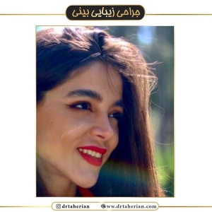 جراحی-بینی-422