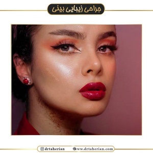 جراحی-بینی-426