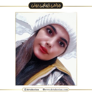 جراحی-بینی-431