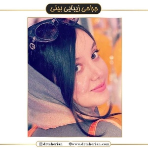 جراحی-بینی-435