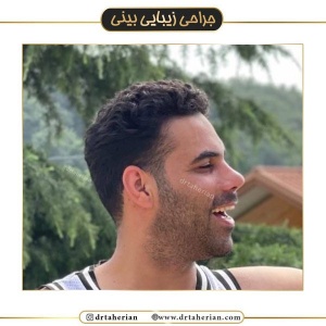 جراحی-بینی-440