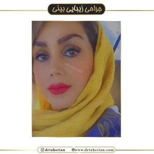 جراحی-بینی-441