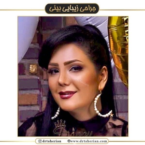 جراحی-بینی-444