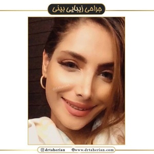 جراحی-بینی-445