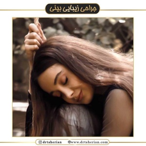 جراحی-بینی-450