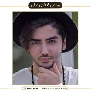 جراحی-بینی-456