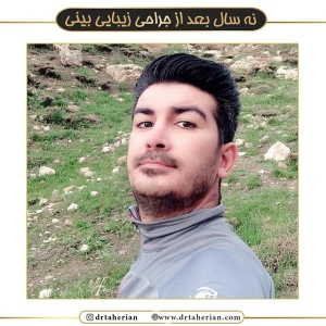 جراحی-بینی-459