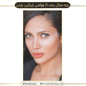 جراحی-بینی-460