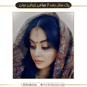 جراحی-بینی-466