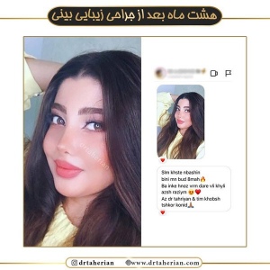 جراحی-بینی-468