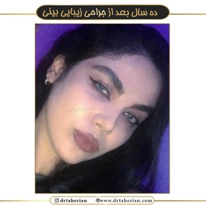 جراحی-بینی-471