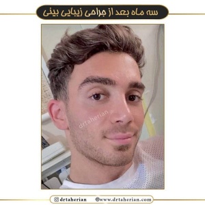 جراحی-بینی-473