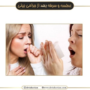 جراحی-بینی-476