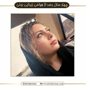 جراحی-بینی-486