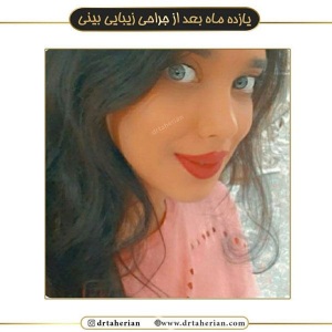 جراحی-بینی-508