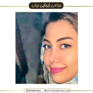 جراحی-بینی-511