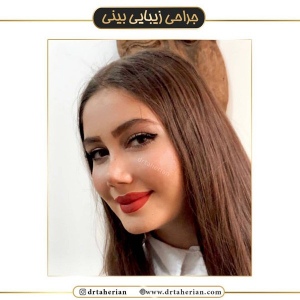 جراحی-بینی-514