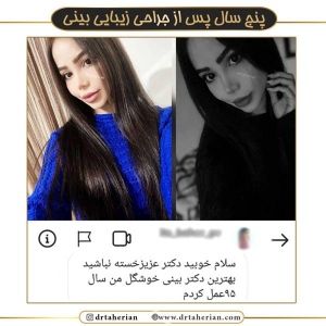 جراحی-بینی-522
