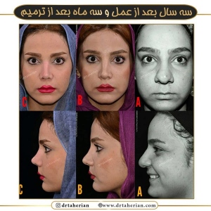 جراحی-بینی-523