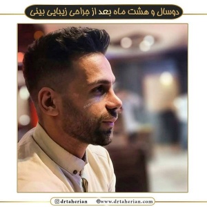 جراحی-بینی-525