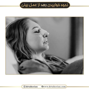جراحی-بینی-526