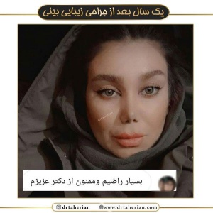 جراحی-بینی-527