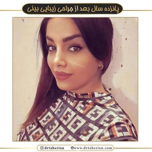 جراحی-بینی-531