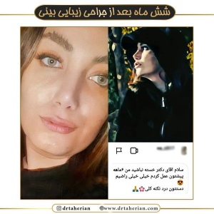 جراحی-بینی-537