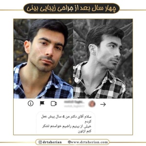 جراحی-بینی-541
