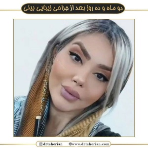 جراحی-بینی-547