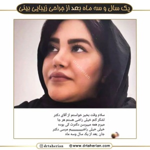 جراحی-بینی-549