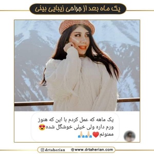 جراحی-بینی-550