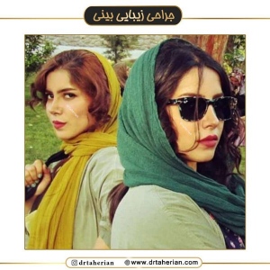 جراحی-بینی-555