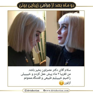 جراحی-بینی-560