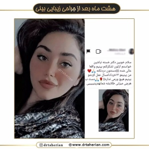 جراحی-بینی-567