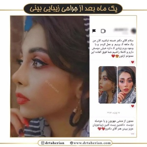 جراحی-بینی-568