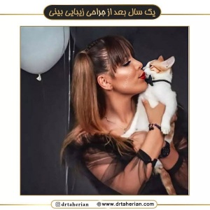 جراحی-بینی-569