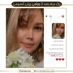 جراحی-بینی-570