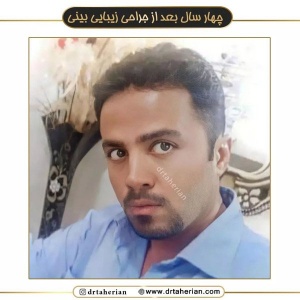 جراحی-بینی-575